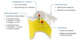 AEROresc® - EASY Collar Zervikalkragen für Erwachsene oder Kinder, einzeln